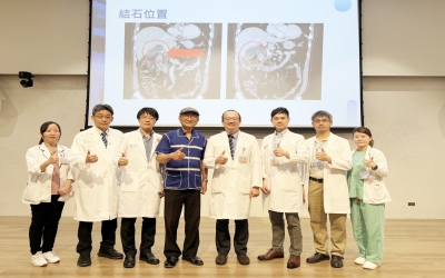 中醫大市立醫院3D腹腔鏡微創手術膽結石解除腹膜炎危機